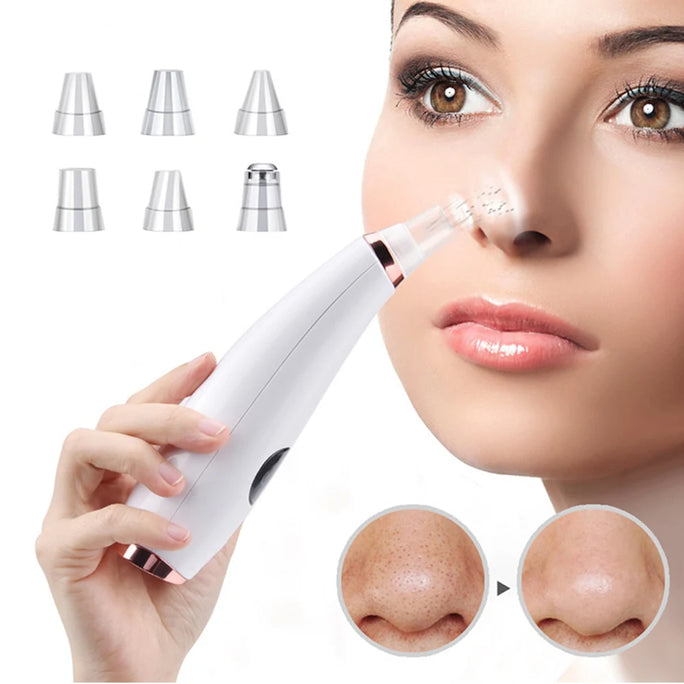 PureGlow Pro – Electric Pore Vacuum & Blackhead Remover